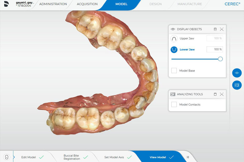 Advanced Designing by Treating Dentist