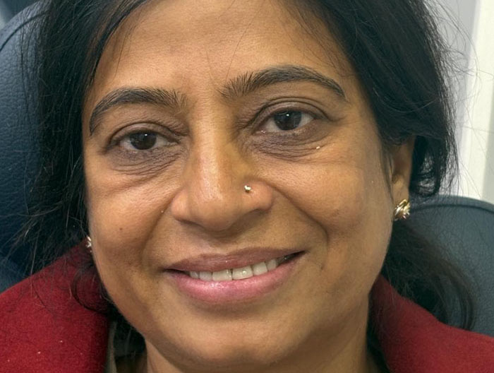 Beautiful veneer smile