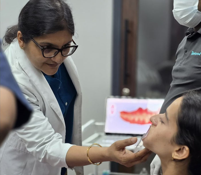 Consultation for veneers