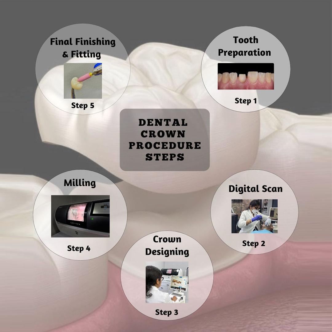 Top class dentistry in delhi