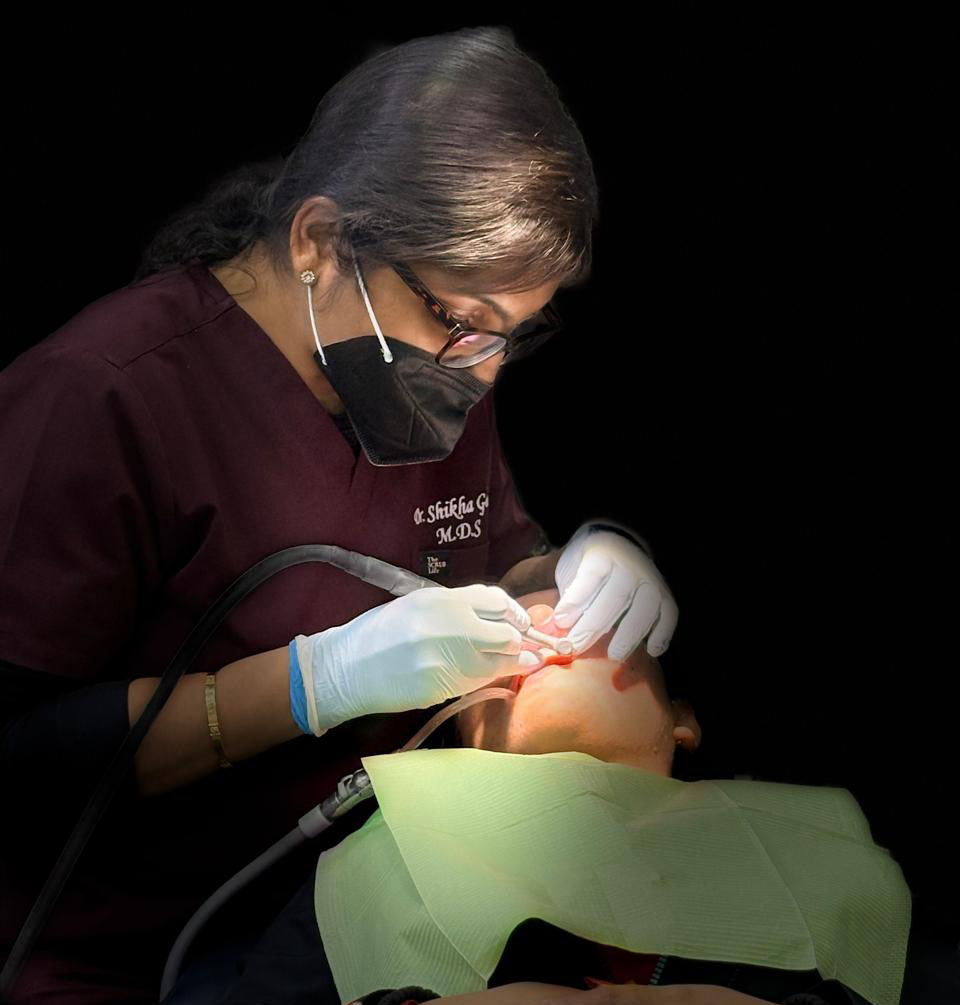 Top Dentist for Veneer in Delhi