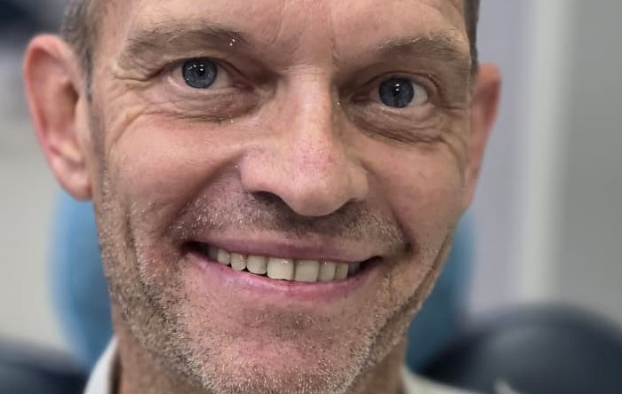 Implant with Ceramic Crown