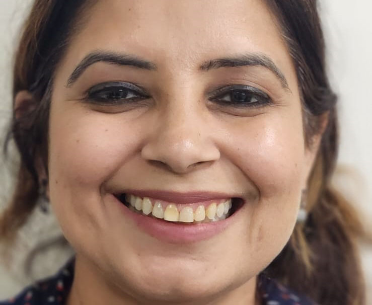 Gaps in protruding teeth