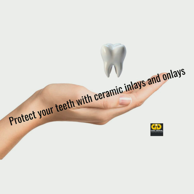 Precision dentistry in Delhi